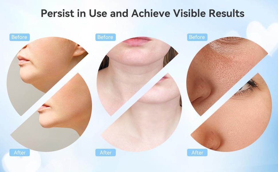 Facial Cleansing Brush 5 in 1 Portable Electric Facial Massager