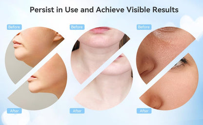 Facial Cleansing Brush 5 in 1 Portable Electric Facial Massager